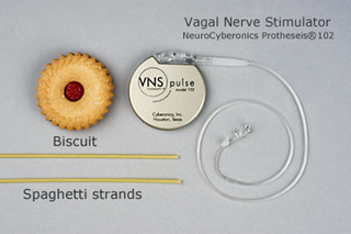 Illustration for article titled A gallery of biotech devices that could give you superpowers right now